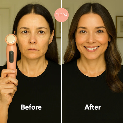 RF Radio Frequency Skin Tightening Device